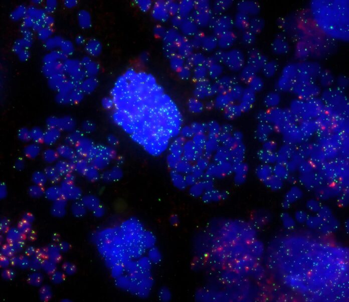 Unexpected-discovery-shows-how-cells-use-telomeres-to-avoid-cancer.jpg