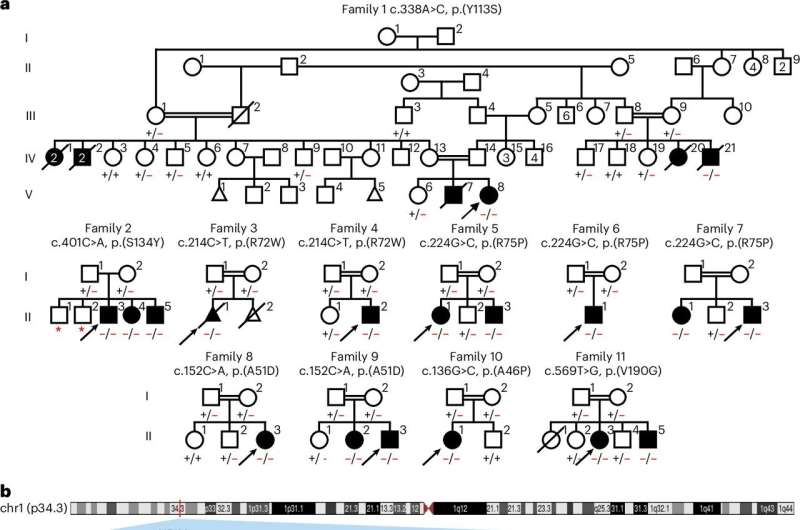 Family pedigrees, variant schematic on gene and protein level and amino acid conservation of AIRIM substitutions. Credit: Nature Cell Biology (2025). DOI: 10.1038/s41556-025-01708-8 Ribosome level changes detected in early brain development