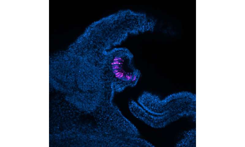 Seeing with fresh eyes: Snails as a system for studying sight restoration