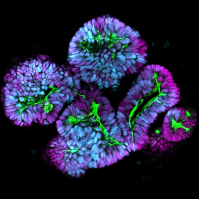 Stem-cell-scientists-unlock-blueprint-for-lab-grown-kidney-cells-with.jpg